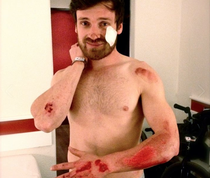 67-stefan-lantschner